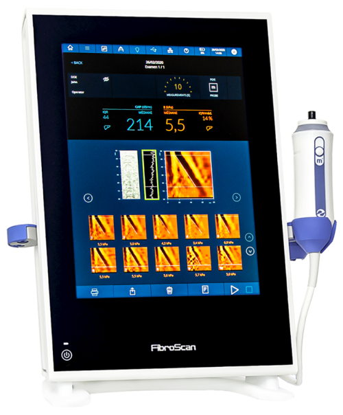 FibroScan® - Gastro - entérologues